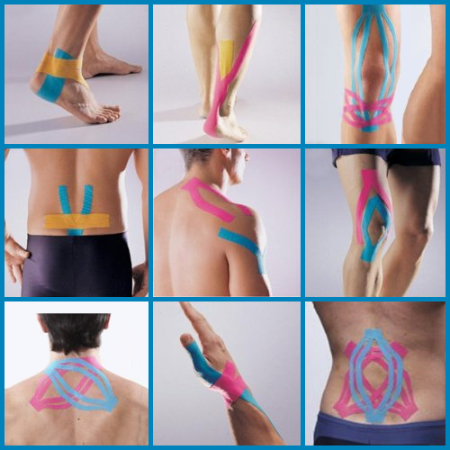 Kinesiotaping